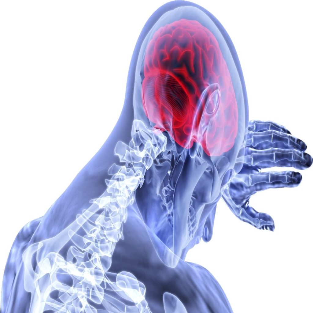 what-are-the-warning-signs-of-a-stroke-li-neurology