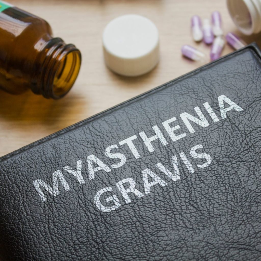 Does Ocular Myasthenia Gravis Get Worse